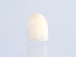 Zirconia Crown